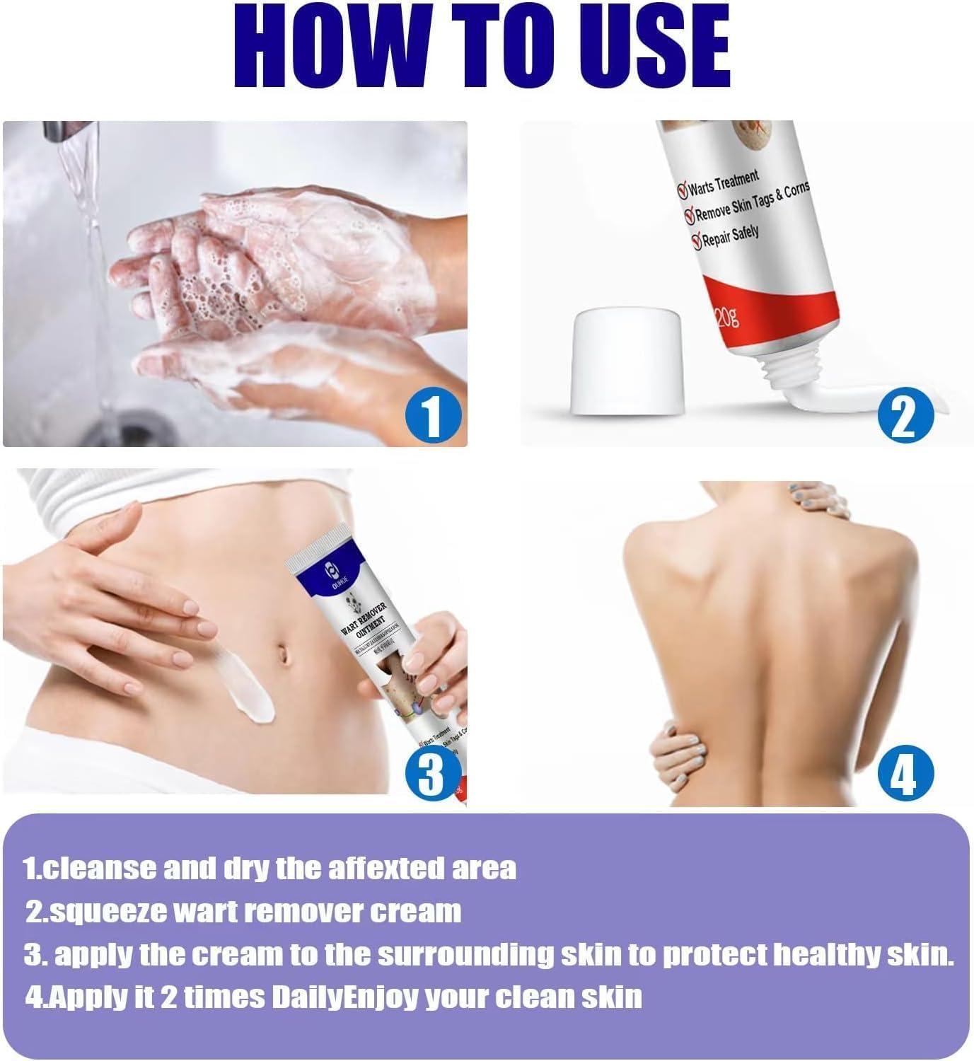 Warts Remover Ointment مرهم إزالة الثآليل