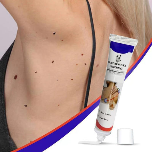 Warts Remover Ointment مرهم إزالة الثآليل